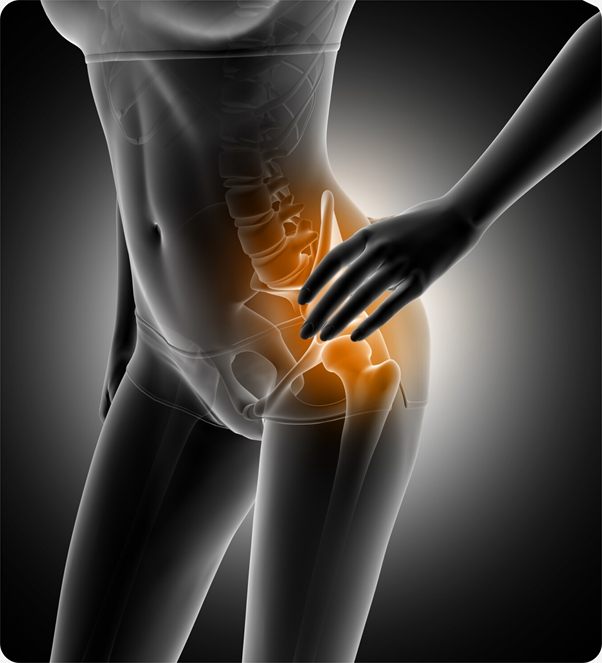 Illustration of a hip joint highlighted in pain